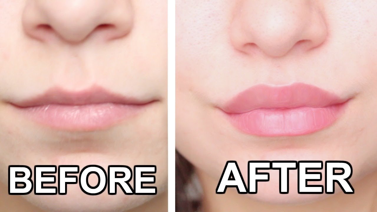 How To Get Bigger Lips