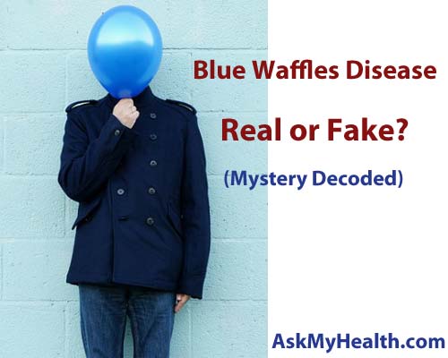 Blue Waffles Disease In Women Men With Pictures Mystery Decoded