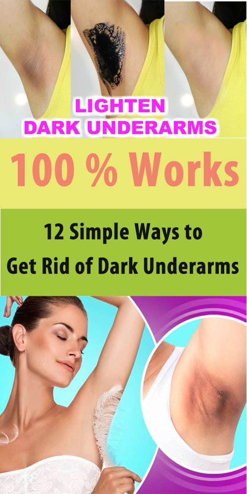 how to get rid of dark underarms