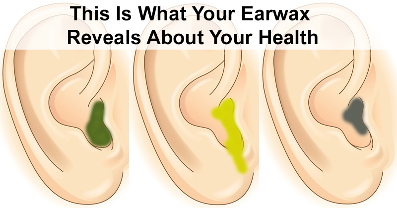 The Color Of Your Earwax Reveals Whats Wrong With Your Health