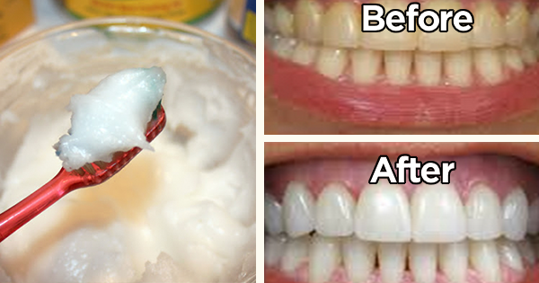 how-to-use-baking-soda-correctly-to-whiten-your-teeth-in-just-5-days