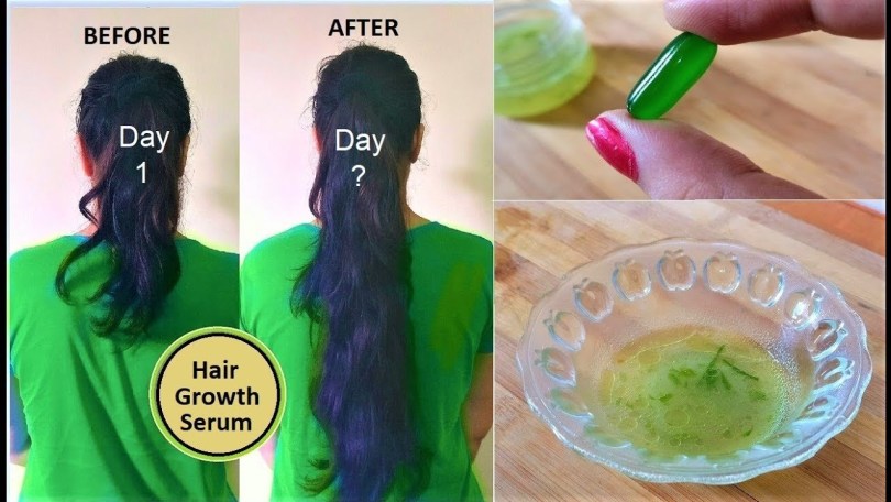 Vitamin E Hair Growth Serum Your Hair Will Just Grow Like Magic 9103