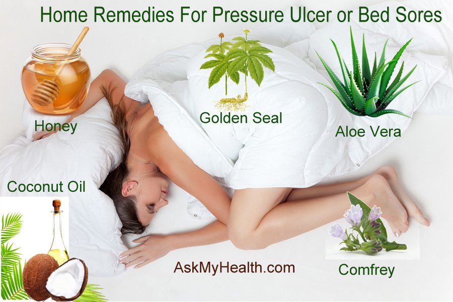 Home Remedies For pressure Ulcer or bed sores