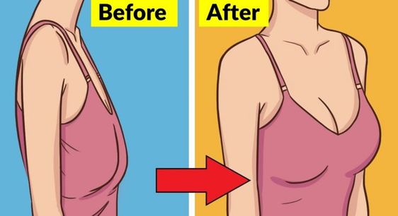 How To Perk Up Your Breasts In Just 7 Days