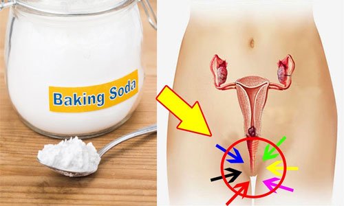 vaginal odor baking soda