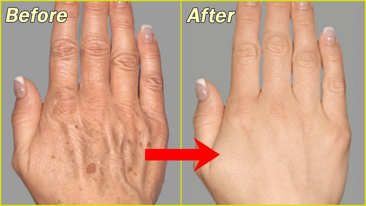 7 Favorite Home Remedies for YoungerLooking Skin Naturally AimDelicious