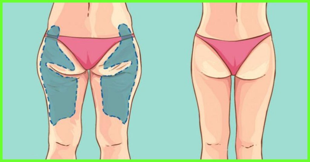 8 Best Exercises to Reduce Cellulite on Thighs