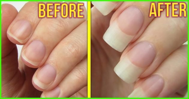 Nails Stopped Breaking